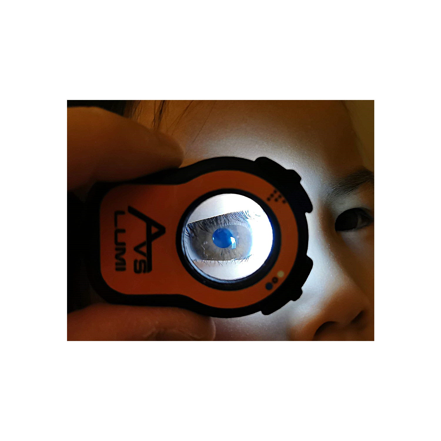 Lumi Anterior Eye Inspector